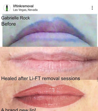 Load image into Gallery viewer, Li-FT Tattoo removal training (£795 incl VAT)