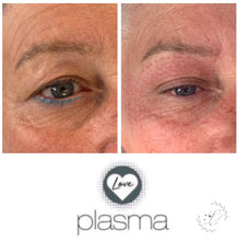 Load image into Gallery viewer, Love Plasma training - Essex (£3600 incl kit)