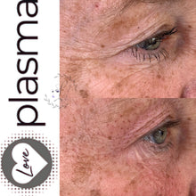 Load image into Gallery viewer, Love Plasma training - Essex (£3600 incl kit)