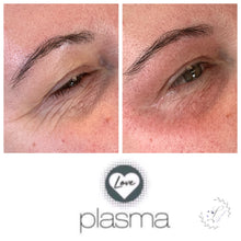 Load image into Gallery viewer, Love Plasma training - Essex (£3600 incl kit)