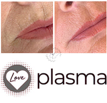Load image into Gallery viewer, Love Plasma training - Essex (£3600 incl kit)