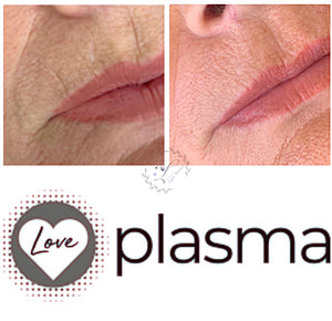 Love Plasma training - Essex (£3600 incl kit)