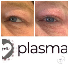 Load image into Gallery viewer, Love Plasma training - Essex (£3600 incl kit)