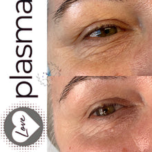 Load image into Gallery viewer, Love Plasma training - Essex (£3600 incl kit)